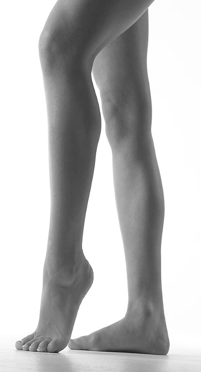 varicose veins signs and symptoms